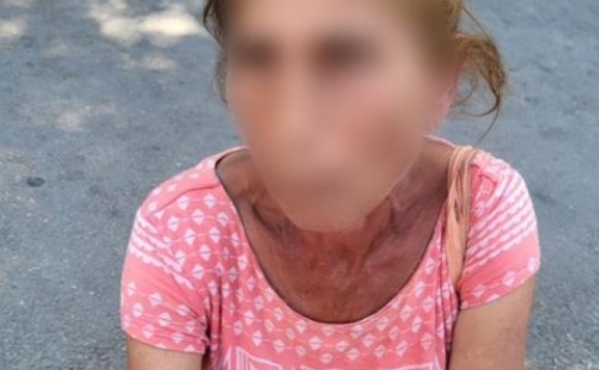 Патрульні Запоріжжя оперативно затримали жінку, причетну до пограбування