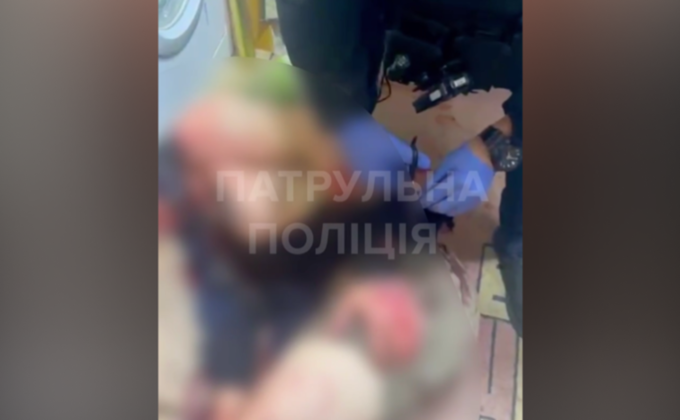 У Запоріжжі патрульні надали допомогу чоловікові після вибуху гранати