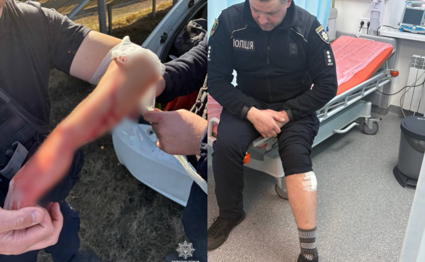 У Запоріжжі під час ворожого обстрілу поранено двох патрульних поліцейських