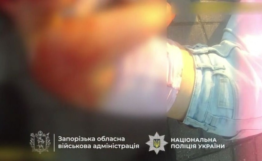 Правоохоронці Запоріжжя врятували дівчинку після ворожого удару